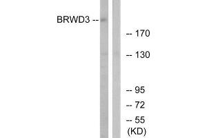 Western Blotting (WB) image for anti-Heat Shock 70kDa Protein 8 (HSPA8) (Internal Region) antibody (ABIN1852554) (Hsc70 antibody  (Internal Region))