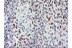 Immunohistochemistry (IHC) image for anti-BTB and CNC Homology 1, Basic Leucine Zipper Transcription Factor 1 (BACH1) antibody (ABIN1496803) (BACH1 antibody)