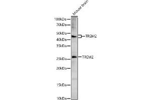 Western blot analysis of extracts of Mouse brain, using TREM2 antibody (ABIN6128834, ABIN6149482, ABIN6149483 and ABIN6214753) at 1:1533 dilution. (TREM2 antibody  (AA 19-160))