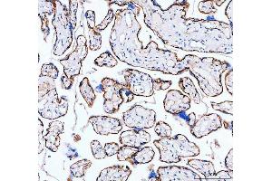 IHC analysis of ITGA5 using anti-ITGA5 antibody (ABIN5693202). (ITGA5 antibody  (AA 42-263))