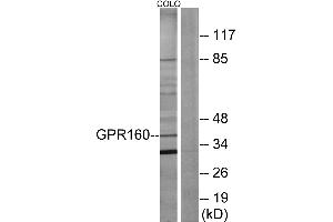 Western blot analysis of extracts from COLO205 cells, using GPR160 antibody. (GPR160 antibody  (C-Term))