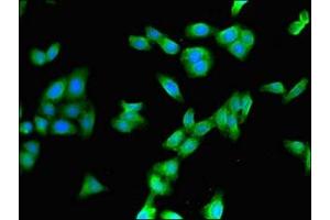 Immunofluorescence (IF) image for anti-Cytochrome P450, Family 3, Subfamily A, Polypeptide 4 (CYP3A4) (AA 259-441) antibody (ABIN7149259)