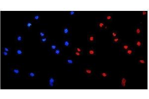 IF analysis of HnRNP A1 using anti-HnRNP A1 antibody (ABIN4886621).