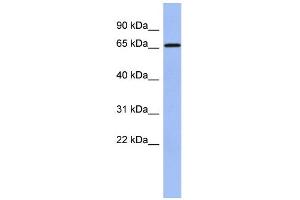 WB Suggested Anti-A1CF Antibody Titration:  0. (A1CF antibody  (N-Term))