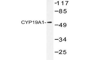 Western blot (WB) analysis of CYP19A1 Antibody in extracts from 293 cells. (Aromatase antibody)