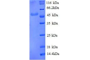 Enolase 3 (Beta, Muscle) (ENO3) (AA 7-432), (partial) protein (His tag) (ENO3 Protein (AA 7-432, partial) (His tag))