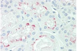 Human Kidney: Formalin-Fixed, Paraffin-Embedded (FFPE) (AQP3 antibody  (AA 163-191))