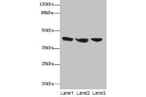 Western blot All lanes: IL2RG antibody at 12 μg/mL Lane 1: Jurkat whole cell lysate Lane 2: K562 whole cell lysate Lane 3: HL60 whole cell lysate Secondary Goat polyclonal to rabbit IgG at 1/10000 dilution Predicted band size: 43, 21 kDa Observed band size: 43 kDa (IL2RG antibody  (AA 75-230))