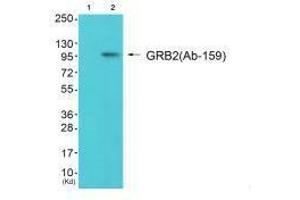 Western blot analysis of extracts from 293 cells (Lane 2), using Gab2 (Ab-159) antiobdy.