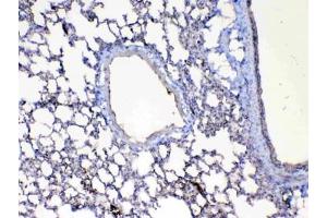 IHC testing of FFPE mouse lung tissue with Factor D antibody at 1ug/ml. (Adipsin antibody  (AA 26-263))