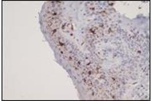 Immunohistochemistry (IHC) image for anti-CD1a (CD1a) (C-Term) antibody (ABIN870499) (CD1a antibody  (C-Term))
