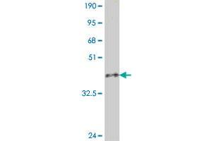 Western Blot detection against Immunogen (36. (LTBP1 antibody  (AA 403-500))