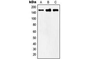 Western blot analysis of MYOM2 expression in human heart (A), mouse heart (B), rat heart (C) whole cell lysates.