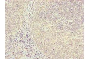 Immunohistochemistry of paraffin-embedded human tonsil tissue using ABIN7152411 at dilution of 1:100 (FBXO22 antibody  (AA 104-403))