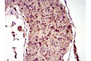 Immunohistochemistry (IHC) image for anti-Microtubule-Associated Protein 1 Light Chain 3 alpha (MAP1LC3A) (AA 1-121) antibody (ABIN1724767)
