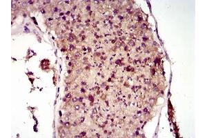 Immunohistochemical analysis of paraffin-embedded testis tissues using MAP1LC3A mouse mAb with DAB staining. (MAP1LC3A antibody  (AA 1-121))