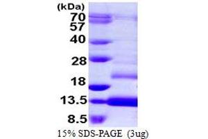 SDS-PAGE (SDS) image for Trefoil Factor 1 (TFF1) (AA 25-84) protein (His tag) (ABIN667932) (TFF1 Protein (AA 25-84) (His tag))