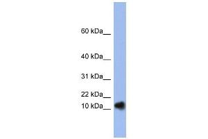 RNASE1 antibody used at 1 ug/ml to detect target protein. (RNASE1 antibody)