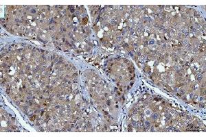 IHC analysis of YWHAE using anti-YWHAE antibody (ABIN7599165). (YWHAE antibody  (AA 1-255))