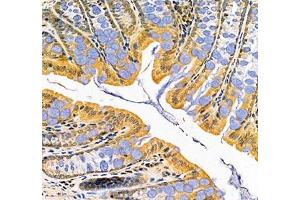 Immunohistochemistry (Paraffin-embedded Sections) (IHC (p)) image for anti-Lactotransferrin (LTF) antibody (ABIN7074457)