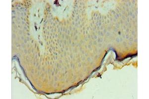 Immunohistochemistry of paraffin-embedded human skin tissue using ABIN7162697 at dilution of 1:100 (PNPLA3 antibody  (AA 377-481))