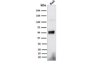 Western Blot Analysis of Raji cell lysate using CD79a Monoclonal Antibody (HM57). (CD79a antibody  (AA 202-216))