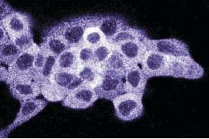 Immunofluorescence staining on A431 cells (Human epithelial carcinoma, ATCC CRL-1555). (Density Regulated Protein antibody  (AA 19-201))