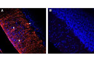 Comparison of immunostaining with Anti-KV1. (Rabbit IgG isotype control (Atto 550))