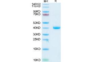 Human R spondin 1 on Tris-Bis PAGE under reduced condition. (RSPO1 Protein (His tag))