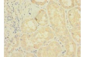 Immunohistochemistry of paraffin-embedded human kidney tissue using ABIN7158162 at dilution of 1:100 (LRRC31 antibody  (AA 1-300))