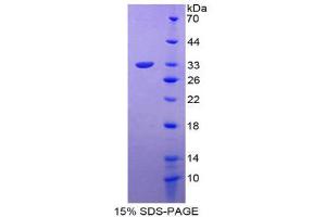 SDS-PAGE (SDS) image for T-Box 4 (TBX4) (AA 284-545) protein (His tag) (ABIN1878577) (TBX4 Protein (AA 284-545) (His tag))