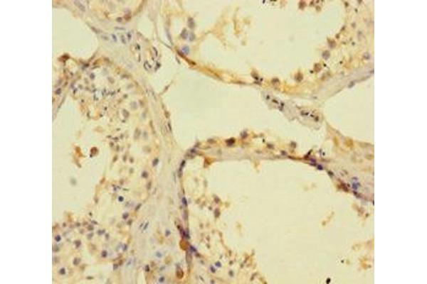 FANCD2 antibody  (AA 1-291)