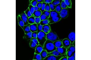 Confocal Immunofluorescent analysis of A431 cells using CF488-labeled EGFR Monoclonal Antibody (GFR450) (Green). (EGFR antibody  (Extracellular Domain) (CF®488A))