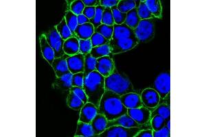 Confocal Immunofluorescent analysis of A431 cells using CF488-labeled EGFR Monoclonal Antibody (GFR450) (Green).