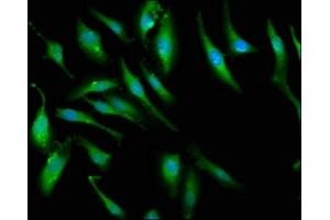 Immunofluorescence staining of Hela cells with ABIN7166420 at 1:66, counter-stained with DAPI. (PCMT1 antibody  (AA 117-228))