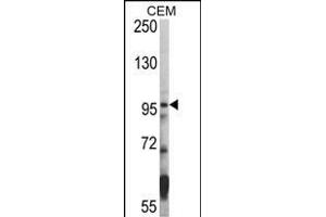 Western blot analysis of hHDAC7- (ABIN387957 and ABIN2844663) in CEM cell line lysates (35 μg/lane). (HDAC7 antibody  (C-Term))
