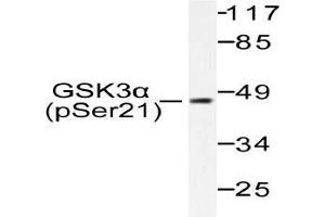 Western blot (WB) analysis of p-GSK3alpha antibody in extracts from ovary cancer. (GSK3 alpha antibody  (pSer21))