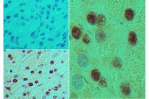 Image no. 1 for anti-Motor Neuron and Pancreas Homeobox 1 (MNX1) (AA 330-380) antibody (ABIN960266) (MNX1 antibody  (AA 330-380))