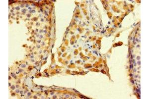 Immunohistochemistry of paraffin-embedded human testis tissue using ABIN7174650 at dilution of 1:100 (ALG14 antibody  (AA 25-216))