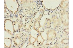 Immunohistochemistry of paraffin-embedded human kidney tissue using ABIN7145704 at dilution of 1:100 (BMPR1A antibody  (AA 177-532))
