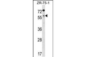 Western blot analysis in ZR-75-1 cell line lysates (35ug/lane). (TCFL5 antibody  (C-Term))