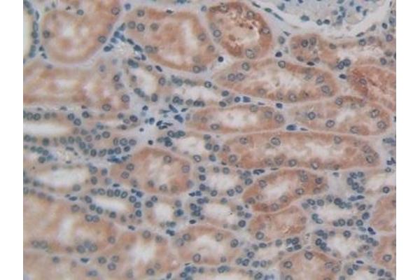 LPCAT3 antibody  (AA 122-233)