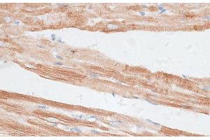 Immunohistochemistry of paraffin-embedded Rat heart using GRK5 Polyclonal Antibody at dilution of 1:100 (40x lens). (GRK5 antibody)