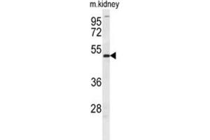 Western Blotting (WB) image for anti-Doublesex and Mab-3 Related Transcription Factor 3 (DMRT3) antibody (ABIN2995697) (DMRT3 antibody)
