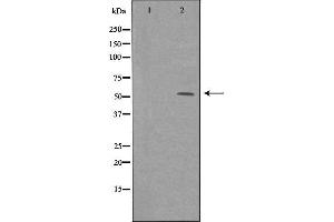 Western blot analysis of extracts from HeLa cells, using ME1 antibody. (ME1 antibody  (C-Term))