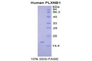 SDS-PAGE (SDS) image for Plexin B1 (PLXNB1) (AA 47-126) protein (His tag) (ABIN1080550)