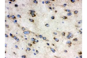 IHC testing of frozen mouse brain tissue with TCP1 antibody. (CCT4 antibody)