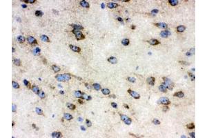 IHC testing of frozen mouse brain tissue with TCP1 antibody.