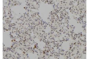 ABIN6277782 at 1/100 staining Rat lung tissue by IHC-P. (Nemo-Like Kinase antibody  (N-Term))