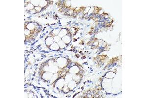 Immunohistochemistry (IHC) image for anti-Interleukin 1 alpha (IL1A) (AA 112-271) antibody (ABIN6142331)